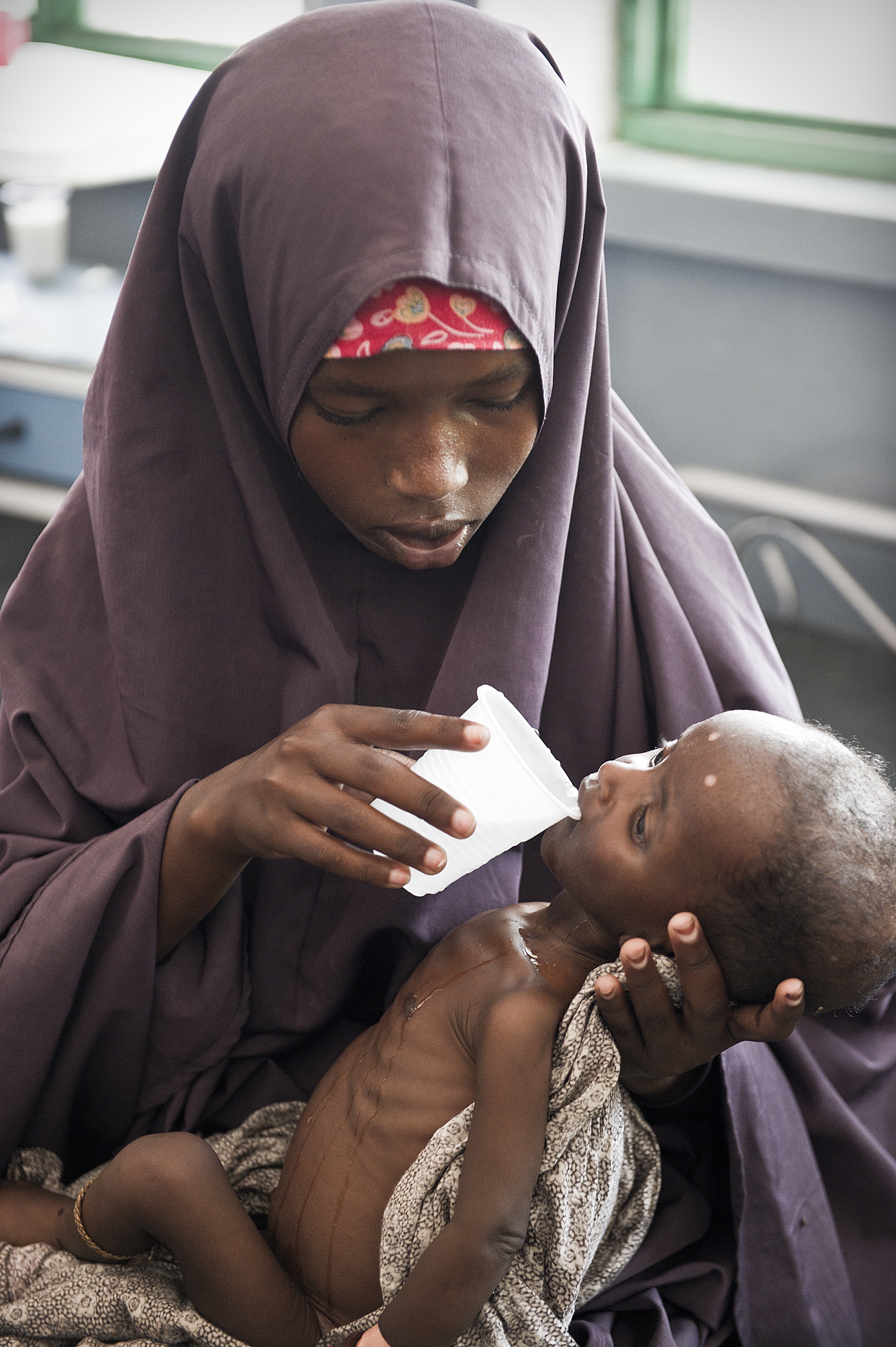 DESPERATE NEED – Pictured here is a young mother feeding her malnourished child. In Somalia a devastating famine has taken lives of tens of thousands of children since July.