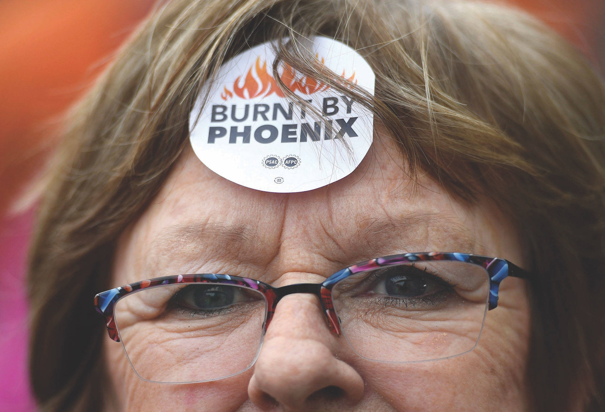Shirley Taylor wears a “Burnt by Phoenix” sticker on her forehead during a rally against the Phoenix payroll system outside the offices of the Treasury Board of Canada in Ottawa on Wednesday, Feb. 28, 2018. THE CANADIAN PRESS/Justin Tang