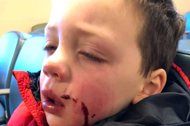 Family warns of dog danger after child bitten at Calgary party